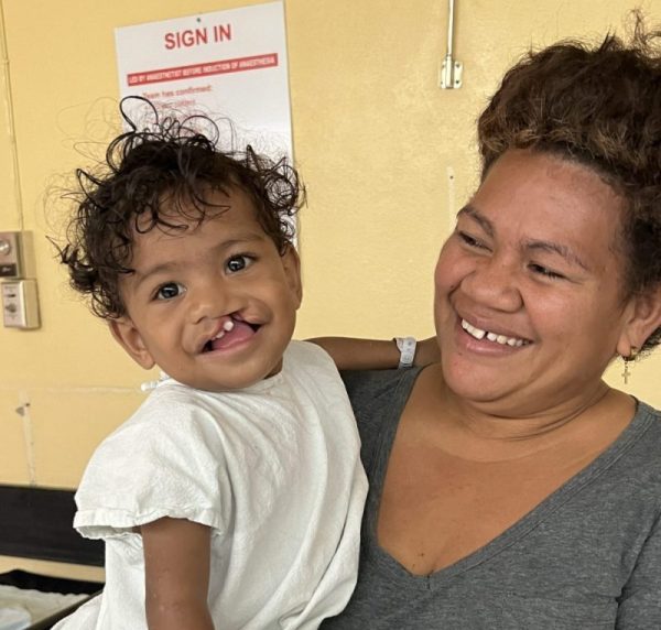 Moceiwai, a young boy with a cleft lip, smiles sunnily in the arms of his mother.