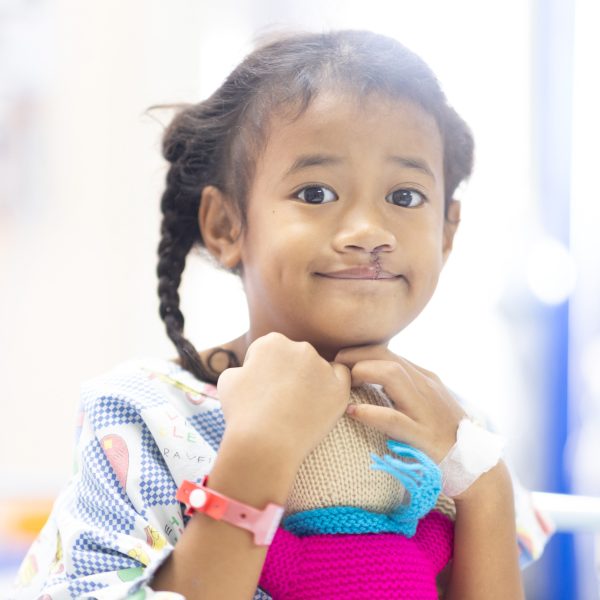 A young girl with stitches in her top lip smiles at the camera.