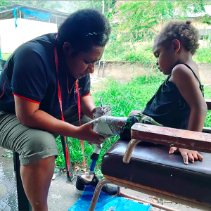 Almah, a woman with a lower limb prosthesis, takes a cast of a young girls residual lower limb.