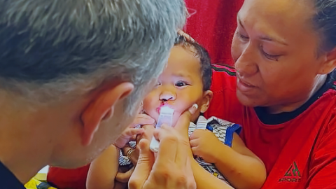 A young patient has their cleft lip and palate examined by Dr Marucci while mum holds them in her arms.