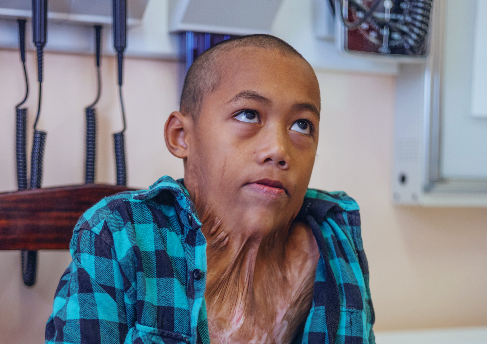 A young boy with significant scar contractures between is head and chest sits in a consultation room.