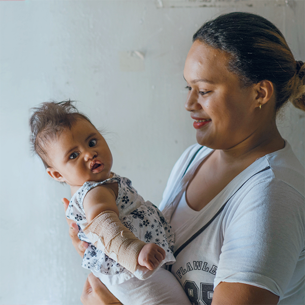 A mother smiles as she holds her baby, who has a recently repaired surgical scar on her top lip.